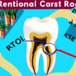 Root Canals and Health: Separating Fact from Fiction